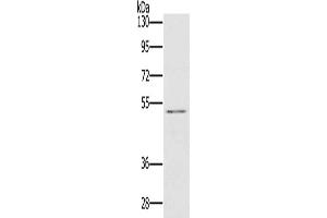 Gel: 8 % SDS-PAGE, Lysate: 40 μg, Lane: HT29 cells, Primary antibody: ABIN7129785(HTR3C Antibody) at dilution 1/500, Secondary antibody: Goat anti rabbit IgG at 1/8000 dilution, Exposure time: 20 seconds (HTR3C Antikörper)