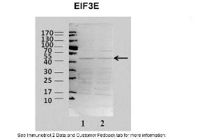 Sample Type: 2. (EIF3E Antikörper  (N-Term))