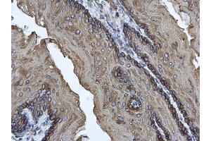 Immunohistochemistry (IHC) image for anti-Keratin 17 (KRT17) antibody (ABIN2855697)