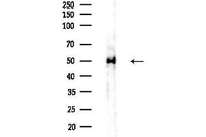 anti-Heterogeneous Nuclear Ribonucleoprotein H1 (H) (HNRNPH1) (Internal Region) antibody