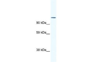 WB Suggested Anti-NFATC2 Antibody Titration:  1. (NFAT1 Antikörper  (N-Term))