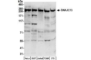anti-DnaJ heat shock protein family (Hsp40) member C13 (DNAJC13) (AA 1175-1225) antibody