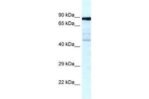 Western Blot showing CKAP2 antibody used at a concentration of 1 ug/ml against Fetal Lung Lysate (CKAP2 Antikörper  (C-Term))