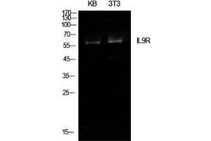 Western Blot (WB) analysis of KB, NIH-3T3 cells using IL-9R Polyclonal Antibody. (IL9 Receptor Antikörper  (Internal Region))