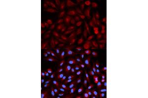 Immunofluorescence analysis of HeLa cells using PSME3 antibody. (PSME3 Antikörper)