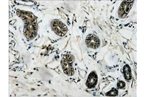 IHC Staining of Human colon tissue, diluted at 1:200. (TUBB3 Antikörper)