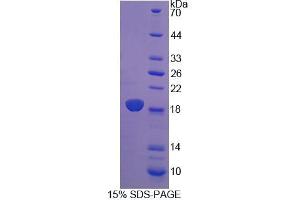 Image no. 1 for Cellular Retinoic Acid Binding Protein 2 (CRABP2) (AA 1-138) protein (His tag) (ABIN6237094)