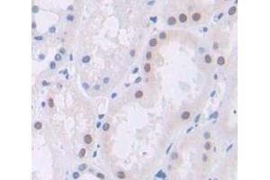 IHC-P analysis of Human Tissue, with DAB staining. (Polybromo 1 Antikörper  (AA 1152-1273))