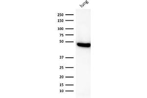 Western Blot Analysis of human lung lysate using CK19 Mouse Recombinant Monoclonal Antibody (rKRT19/800). (Rekombinanter Cytokeratin 19 Antikörper)