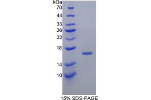 SDS-PAGE analysis of Guinea Pig Transthyretin Protein.