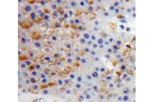 IHC-P analysis of Liver tissue, with DAB staining. (PTPRS Antikörper  (AA 77-361))