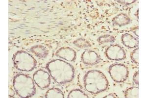 Immunohistochemistry of paraffin-embedded human colon tissue using ABIN7143116 at dilution of 1:100 (ACTRT1 Antikörper  (AA 201-376))