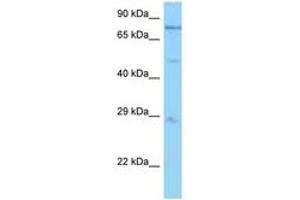 Image no. 1 for anti-Proteasome (Prosome, Macropain) 26S Subunit, ATPase, 1 (PSMC1) (AA 71-120) antibody (ABIN6748218)