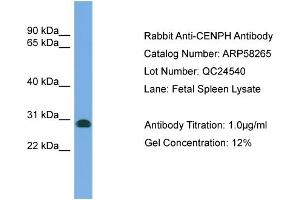 WB Suggested Anti-CENPH  Antibody Titration: 0. (CENPH Antikörper  (N-Term))