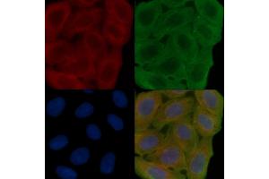 ABIN6266202 and ABIN6277355 staining Hela cells(30 min of UV treatment) by IF/ICC.