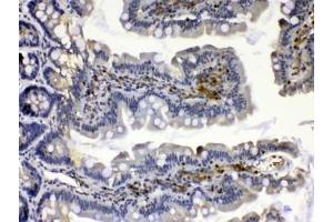 IHC testing of FFPE rat small intestine tissue with Calpain 2 antibody at 1ug/ml. (Calpain 2 Antikörper)