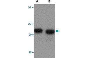 Western blot analysis of NIPSNAP1 in human brain tissue lysate with NIPSNAP1 polyclonal antibody  at (A) 0.