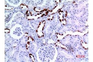 Immunohistochemistry (IHC) image for anti-Keratin 8 (KRT8) (Ser726), (Ser731) antibody (ABIN3187841)