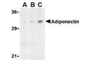 Western blot analysis of adiponectin in rat brain cell lysate with AP30023PU-N adiponectin antibody at (A) 1, (B) 2, and (C) 4 μg/ml. (ADIPOQ Antikörper  (N-Term))