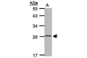 WB Image Sample(30 μg of whole cell lysate) A:MOLT4 whole cell lysate , 12% SDS PAGE antibody diluted at 1:1000 (CMTM5 Antikörper  (C-Term))