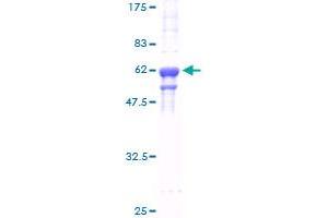 Image no. 1 for Heterogeneous Nuclear Ribonucleoprotein A2/B1 (HNRNPA2B1) (AA 1-249) protein (GST tag) (ABIN1306867)