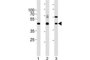 Western blot analysis of lysate from 1) mouse kidney, 2) mouse thymus and 3) rat lung tissue lysate using Dlk1 antibody. (DLK1 Antikörper  (C-Term))