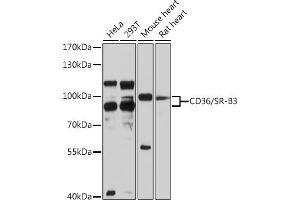 Western blot analysis of extracts of various cell lines, using CD36/SR-B3 antibody (ABIN3015504, ABIN3015505, ABIN1679086, ABIN5663919 and ABIN6218561) at 1:3000 dilution. (CD36 Antikörper  (AA 301-400))
