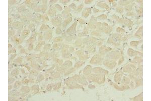 Immunohistochemistry of paraffin-embedded human heart tissue using ABIN7150764 at dilution of 1:100 (DUSP22 Antikörper  (AA 1-184))