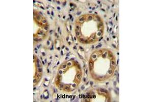 CXCR3 Antibody (Center) immunohistochemistry analysis in formalin fixed and paraffin embedded human kidney tissue followed by peroxidase conjugation of the secondary antibody and DAB staining.