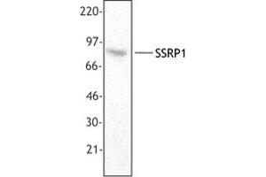 Image no. 1 for anti-Structure Specific Recognition Protein 1 (SSRP1) antibody (ABIN205478) (SSRP1 Antikörper)
