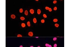 Immunofluorescence analysis of HeLa cells using MonoMethyl-Histone H3-K9 Polyclonal Antibody at dilution of 1:100.