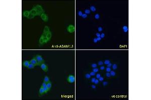 ABIN185301 Immunofluorescence analysis of paraformaldehyde fixed A431 cells, permeabilized with 0. (ADAM12 Antikörper  (N-Term))