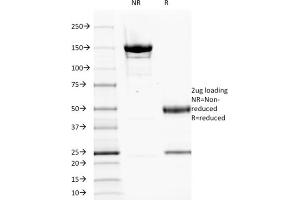 SDS-PAGE Analysis Purified EGFR Mouse Monoclonal Antibody (GFR1195). (EGFR Antikörper  (Extracellular Domain))