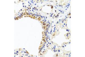 Immunohistochemistry of paraffin-embedded rat lung using CXCL8 antibody (ABIN6290535) at dilution of 1:100 (40x lens). (IL-8 Antikörper)