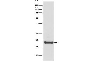 Western blot analysis of ARF6 expression in 293T cell lysate. (Rekombinanter ARF6 Antikörper)