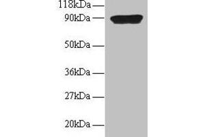 Western blot All lanes: CXCL5 antibody at 2 μg/mL + 293T whole cell lysate Secondary Goat polyclonal to rabbit IgG at 1/15000 dilution Predicted band size: 12 kDa Observed band size: 90 kDa (CXCL5 Antikörper  (AA 37-110))