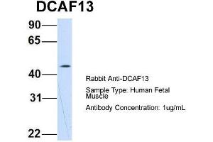 Host: Rabbit  Target Name: DCAF13  Sample Tissue: Human Fetal Muscle  Antibody Dilution: 1. (DCAF13 Antikörper  (N-Term))