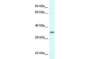 WB Suggested Anti-PDLIM1 Antibody Titration: 1.