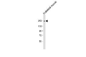 Anti-MYH4 Antibody (N-Term) at 1:1000 dilution + human skeletal muscle lysate Lysates/proteins at 20 μg per lane. (MYH4 Antikörper  (AA 346-380))