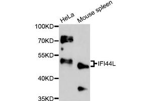Western blot analysis of extracts of various cell lines, using IFI44L antibody (ABIN6292158) at 1:3000 dilution. (IFI44L Antikörper)