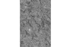 Adult rat thalamus immunohistochemistry of axon initial segments. (Ankyrin G Antikörper)