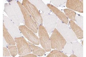 ABIN6266991 at 1/100 staining human Skeletal muscle tissue sections by IHC-P. (COL12A1 Antikörper  (Internal Region))