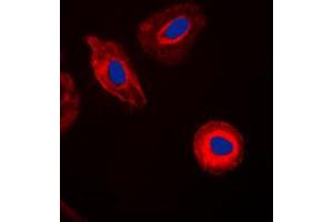 Immunofluorescent analysis of Galectin 8 staining in HepG2 cells.
