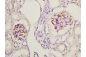 Formalin-fixed and paraffin embedded mouse kidney labeled with Rabbit Anti-Nephrin Polyclonal Antibody, Unconjugated (ABIN2177857) at 1:200 followed by conjugation to the secondary antibody and DAB staining (Nephrin Antikörper  (AA 451-550))