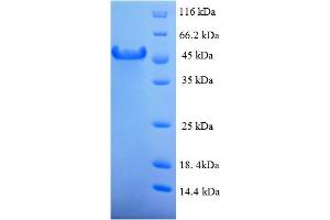 SDS-PAGE (SDS) image for Hyaluronan Binding Protein 2 (HABP2) (AA 37-313), (partial) protein (His-SUMO Tag) (ABIN5711269) (HABP2 Protein (AA 37-313, partial) (His-SUMO Tag))
