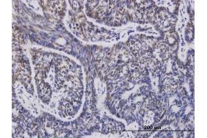 Immunostaining (ISt) image for anti-Ubiquitin-Conjugating Enzyme E2D 1 (UBE2D1) (AA 1-94) antibody (ABIN521211)