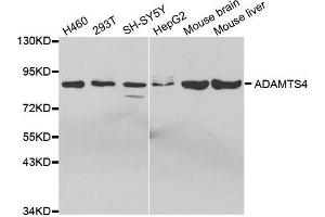 Western blot analysis of extracts of various cell lines, using ADAMTS4 antibody. (ADAMTS4 Antikörper  (AA 52-315))