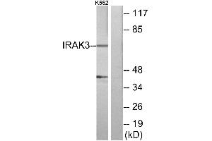Immunohistochemistry analysis of paraffin-embedded human brain tissue using IRAK3 antibody. (IRAK3 Antikörper)