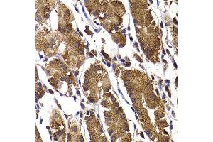 Immunohistochemistry of paraffin-embedded human stomach using STAMBP antibody at dilution of 1:100 (x400 lens).