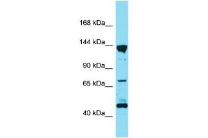 Western Blotting (WB) image for anti-Liprin alpha 3 (PPFIA3) (C-Term) antibody (ABIN2791058) (LIPA3 Antikörper  (C-Term))